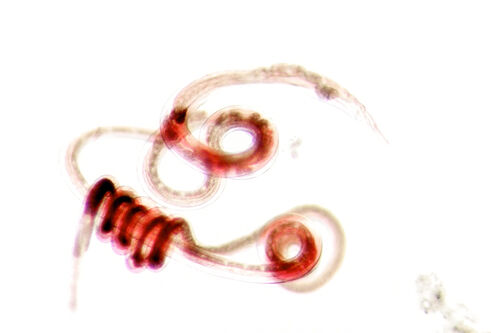 A through-microscope image of a stunted worm, appearing red, that has curled up on a white background.